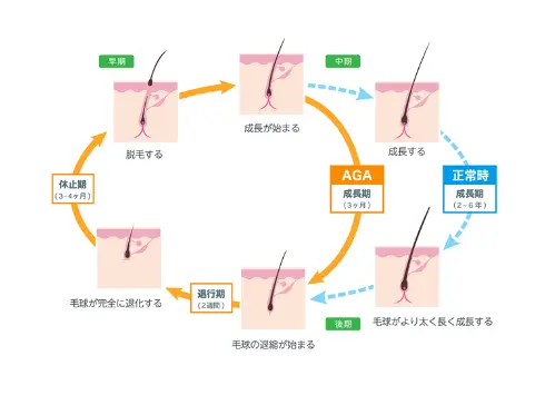 ヘアサイクルの終わりは毛根の寿命