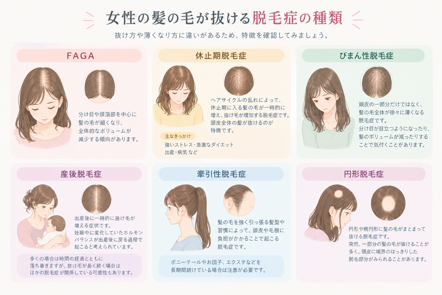 女性の脱毛症の種類のイラスト